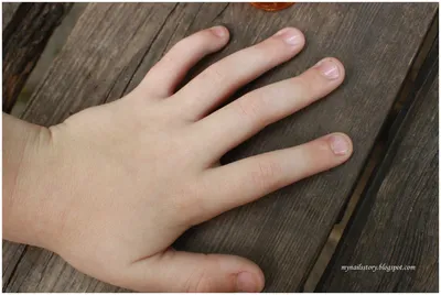 Привычка грызть ногти: эстетическое решение проблемы - pro.bhub.com.ua