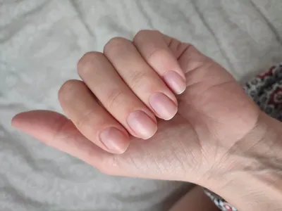 Почему ногти становятся волнистыми на пальцах рук и ног? | 4-Women.ru | Дзен