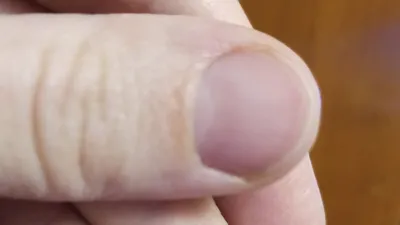 Волнистые ногти — 5 ответов | форум Babyblog