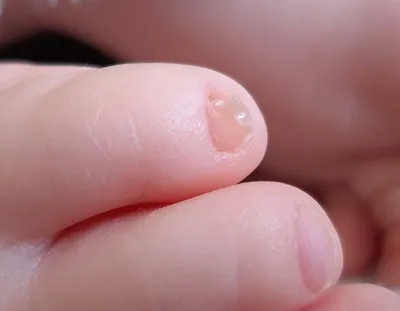 Эволюция ногтей у ребенка — 40 ответов | форум Babyblog