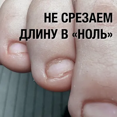 🧐О чем расскажут ногти? 👋Состояние ногтей отражает состояние здоровья. ✓У  здоровых детей ноготки гладкие, ровные, нежно-розового… | Instagram