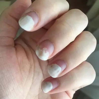 Всеми любиммая рубрика \"До\" и \"После\" наращивание ногтей ну как вам? 🤔 |  Instagram