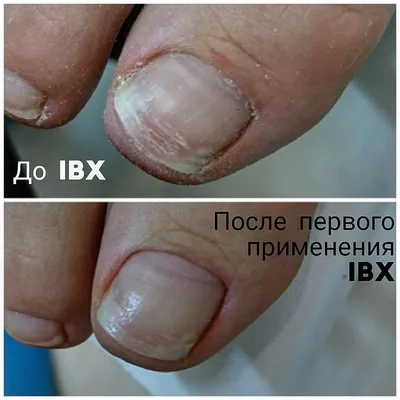 Как спасти ногти после гель-лака и наращивания 💅 | theGirl