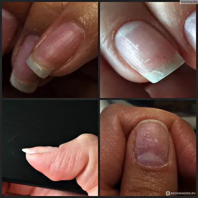 Как восстановить ногти после гель-лака. Личный опыт | Отзывы покупателей |  Косметиста