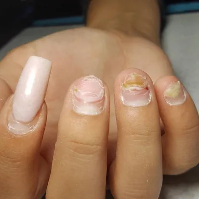 Лак для ногтей TRIND Nail Repair - «Восстановила ногти после шеллака. Фото  До и После. Вы только посмотрите на это чудо!!! Теперь советую всем  знакомым» | отзывы
