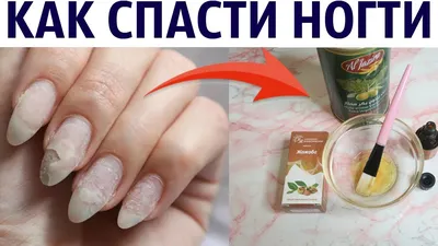 SHOT: Москвичка осталась без ногтей на нескольких пальцах после шеллака в  салоне