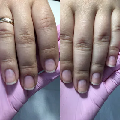 Как ухаживать за ногтями после процедуры шеллака