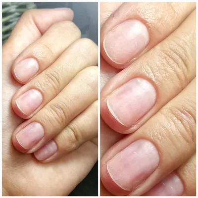 Отказалась от гель-лака на 6 месяцев: показываю, как изменились ногти за  это время. Фото до и после | K O S M E T O S | Дзен