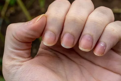 Ногти-индикаторы. О каких проблемах со здоровьем можно узнать, рассмотрев  свои ногти | Дневник здоровья | Дзен
