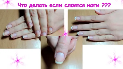 Слоятся, ломаются ногти? Как с этим бороться | Beauty блендер | Дзен