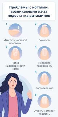 ТОП 7 способов лечения и укрепления слоящихся ногтей | 7Дней.ру