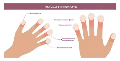 Elle. Nails. Md - Ногти «КОРШУНЫ» и Ногти «ТРУБОЧКИ» ⠀ Вот... | Facebook