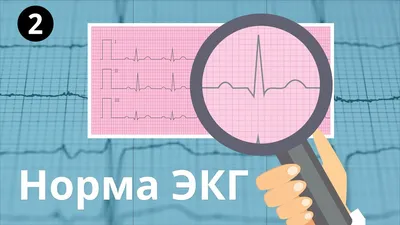 Норма ЭКГ. Все интервалы и зубцы: p, QRS, T, PR, ST - YouTube