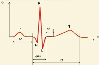 Контурный анализ ЭКГ