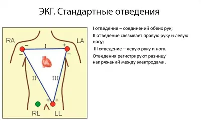 Электрокардиограмма - Доказательная медицина для всех