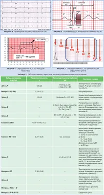 ЭКГ-азбука клинициста | Інтернет-видання \"Новини медицини та фармації\"