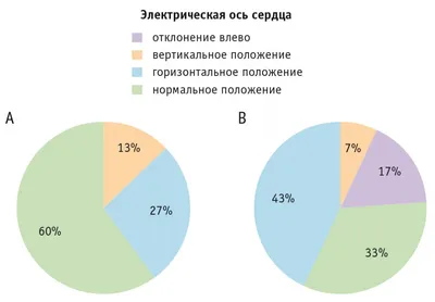 Зубец Т на ЭКГ - норма и патология - E-Cardio