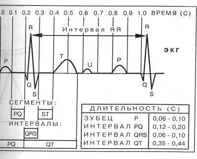 Физиологическое спортивное сердце. Основные изменения