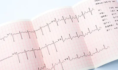 Может ли ЭКГ не показать инфаркт? | Кардиолог Константин Крулёв | Дзен