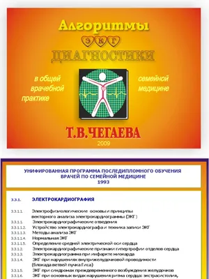 ЭКГ – диагностика состояния сердца. Показания к ЭКГ, что показывает  исследование. Как делают ЭКГ