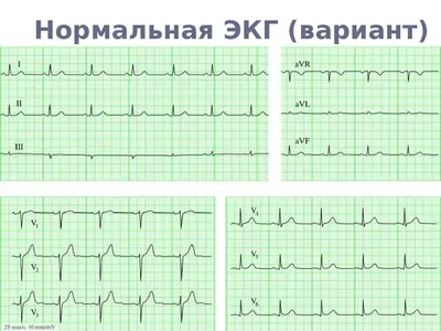 Журнал МЕДИЦИНА