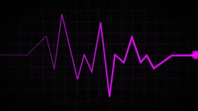 Как расшифровать кардиограмму сердца самостоятельно в домашних условиях:  нормы у мужчин, женщин и детей по возрасту, таблица