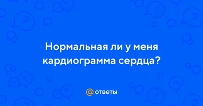 Электрокардиография (ЭКГ) - «Неинвазивная, информативная и простая  процедура. Регистрация активности сердечной мышцы. Пример норм ЭКГ и  патологий» | отзывы