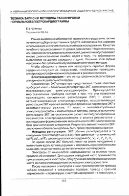 ЭКГ - что это такое, основные понятия и характеристики электрокардиограммы