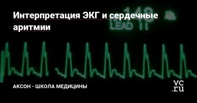Нормальная линия сердцебиения на электрокардиограмме синусовый ритм экг экг  указывает на символ здоровья жизни в медицине | Премиум Фото