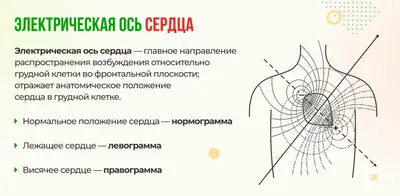 Определение электрической оси сердца