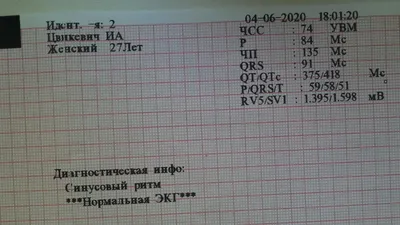Интерпретация ЭКГ и сердечные аритмии — Аксон - школа медицины на vc.ru