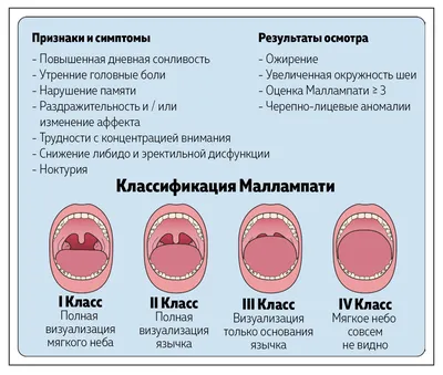Ангина - лечение и симптомы, диагностика ангины в Москве, Клинический  Госпиталь на Яузе