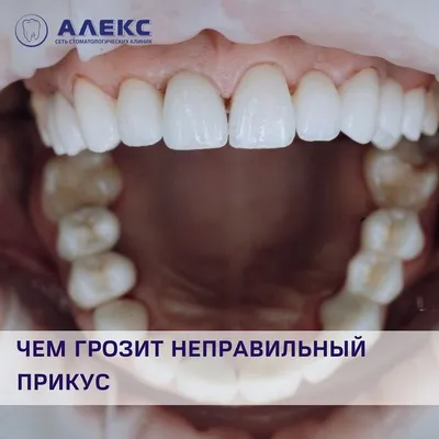 Правильный прикус и ровные зубы | «Доктор Зубов»