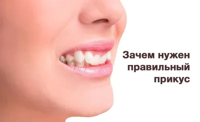 Зачем нужен правильный прикус | ✓Стайл-С: понятная стоматология |Москва —  Отрадное| | Дзен