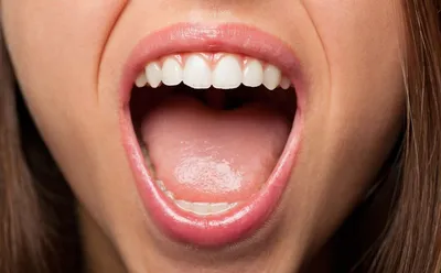 Правильный прикус зубов — каким он должен быть и как выглядеть