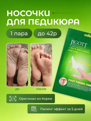 Япония против Кореи: Носочки для педикюра Sosu Foot Peeling Pack-Perorin и  Отшелушивающая маска-носки Skinlite Exfoliating Foot Mask | Отзывы  покупателей | Косметиста