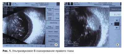 Новообразования век у собак и кошек - ветеринарная офтальмология Реком