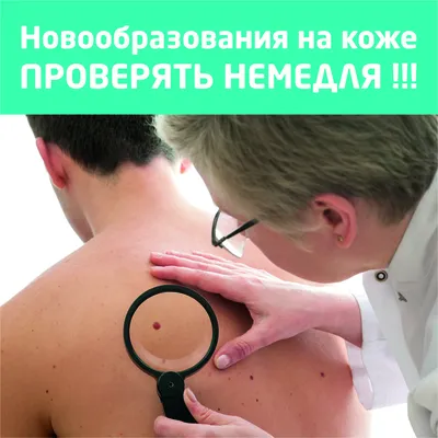 Почему нужно удалять новообразования на коже | HappyDerm