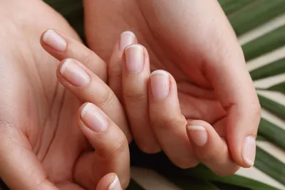 О чем говорят ногти: 10 признаков заболеваний | Nika Nagel | Дзен