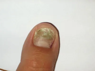 О чем расскажут ваши ногти: состояние ногтей и что с ними может быть не так  / Оффтопик / iXBT Live
