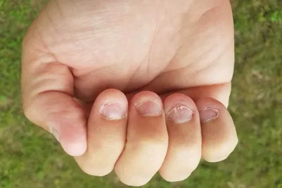 Маникюр на сгрызенные ногти (53 фото)