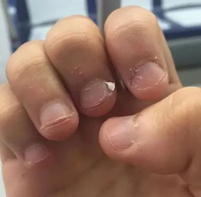Маникюр на обгрызанные ногти без наращивания (21 фото)