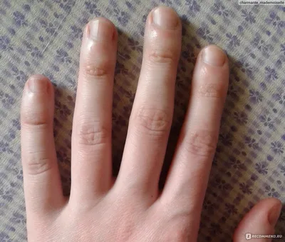 Маникюр на обгрызенных ногтях (25 фото)