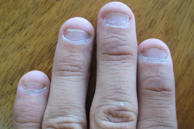 Исправляем вредную привычку: как восстановить поврежденные ногти?