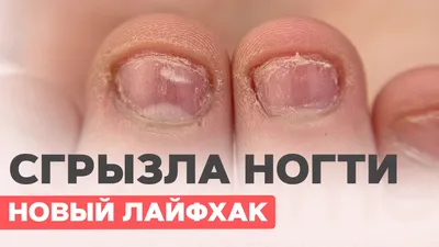 Преображение ОБКУСАННЫХ ногтей / Наращивание на Ногти Грызунчика / Татьяна  Бугрий - YouTube