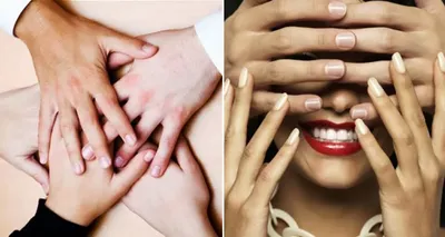 8 надежных способов перестать грызть ногти