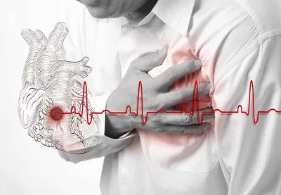 МРТ Эксперт» и «Клиника Эксперт» - Боль в груди: всегда ли сердце? ⠀ О  характеристиках болей в области сердца, возможных причинах их появления  рассказывает врач-кардиолог «Клиника Эксперт» Иркутск Наталья Александровна  Шелест. ⠀