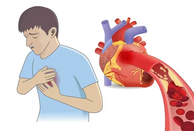 Габор Рубани: «Мобилизация потенциала сердца может предотвратить инфаркт»