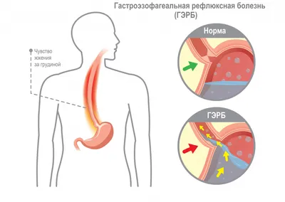 Сердце не выдержит