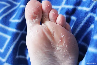 Педикюрные носочки Sosu С ароматом мяты - «\"Обожаю сдирать кожу с пяток\" -  для любителей выдавливать прыщи и облазить после загара.» | отзывы